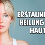 Probleme mit der Haut? Erstaunliche Heilung durch natürliche Kosmetik