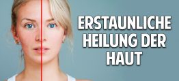 Probleme mit der Haut? Erstaunliche Heilung durch natürliche Kosmetik