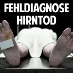 Fehldiagnose Hirntod: Wann ist der Mensch wirklich tot?