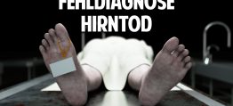 Fehldiagnose Hirntod: Wann ist der Mensch wirklich tot?