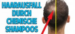 Haarausfall, graue Haare & Schuppen: Ohne chemische Shampoos zu natürlich gesunden & schönen Haaren