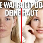 Die Wahrheit über Deine Haut: Unglaubliche Heilung bei Neurodermitis, Schuppenflechte & Akne