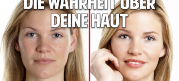 Die Wahrheit über Deine Haut: Unglaubliche Heilung bei Neurodermitis, Schuppenflechte & Akne Die Wahrheit über Deine Haut: Unglaubliche Heilung bei Neurodermitis, Schuppenflechte & Akne