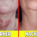 Erstaunliche Heilung der Haut durch Aktivierung des Stoffwechsels – Wie funktioniert unsere Haut? Erstaunliche Heilung der Haut durch Aktivierung des Stoffwechsels – Wie funktioniert unsere Haut?